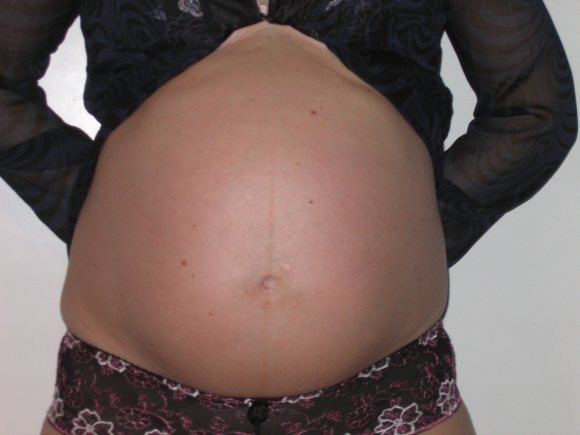 obrázek ke článku Nejdůležitější doplňky stravy pro těhotné a kojící ženy
